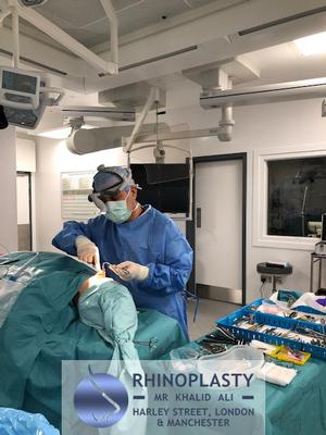 Rhinoplasty Manchester, Liverpool & Leeds. Mr Khalid Ali during nose reshaping operation.